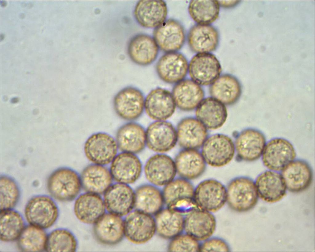 Comatricha o Stemonitopsis?